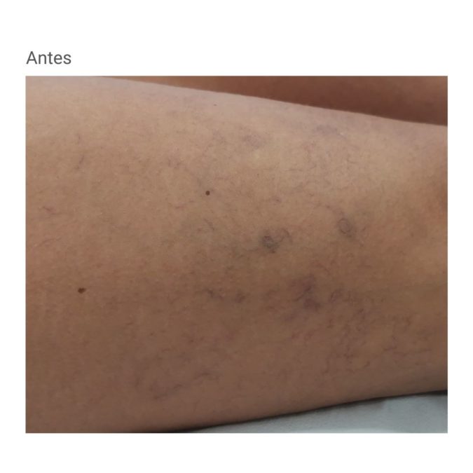 Specialist in varicose vein treatment
