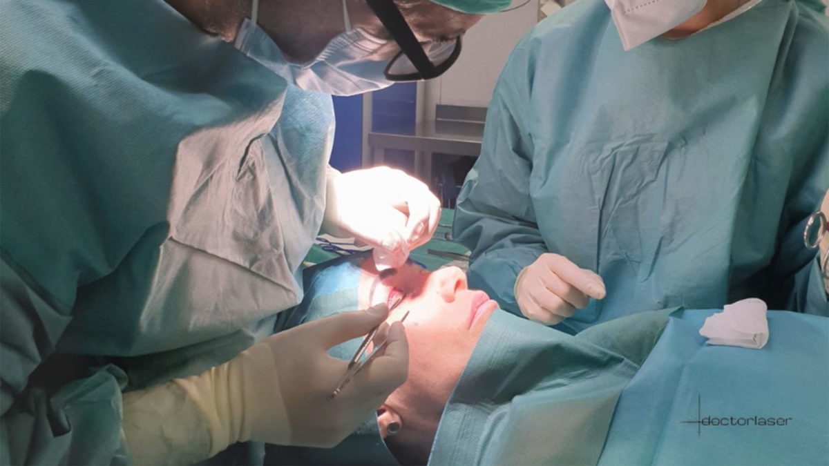 Blepharoplasty result