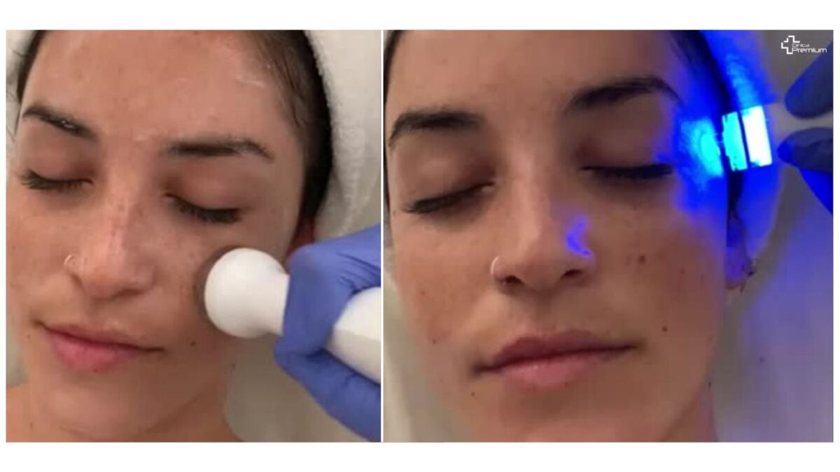 Tratamiento facial AQUAPURE
